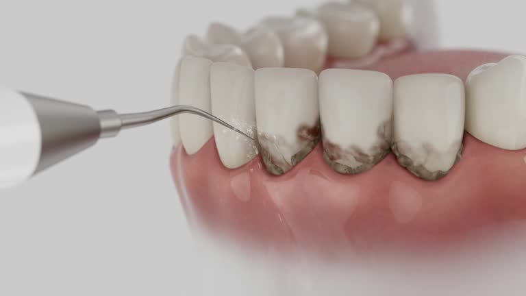 Reliable Dental Implants contractor in Greenland, AR by Smile Center Dentistry